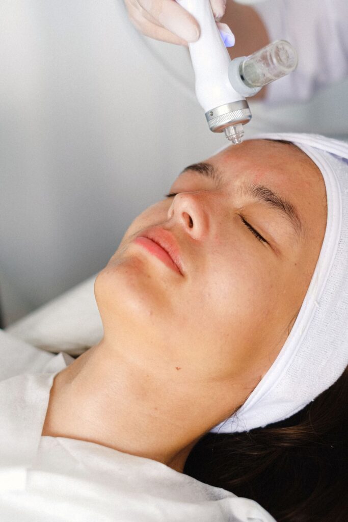 Microneedling Facial Miami